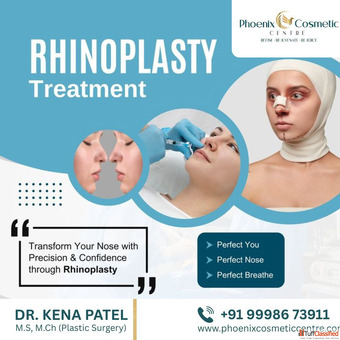Phoenix Cosmetic Centre - Expert Nose Reshaping Ahmedabad