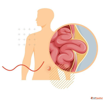 Trusted Specialist for Minimally Invasive Surgery in Ahmedabad