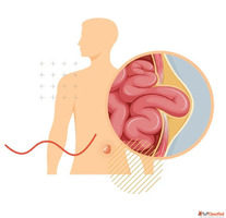 Trusted Specialist for Minimally Invasive Surgery in Ahmedab...
