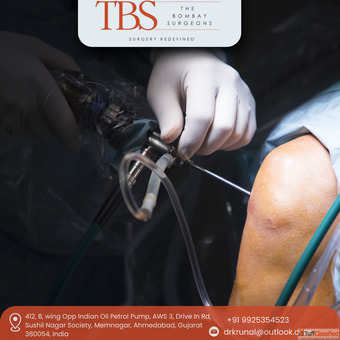 Trusted Knee Arthroscopy Treatment in Ahmedabad - Dr. Krunal Soni