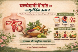 Uterine Fibroids Symptoms Causes Diagnosis and Natural Treat...