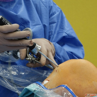 Top Knee Replacement Surgeon in Ahmedabad - Elite Hospital