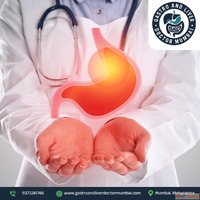 Best Stomach Cancer Treatment in Mumbai by Expert Gastro Spe...
