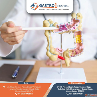 Gastro1 Hospital - Best IBS Treatment in Ahmedabad with Proven Care