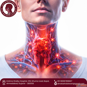 Expert Thyroid Cancer Surgeon in Ahmedabad Dr. Natasha Lalwani