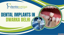 Trusted Dental Implants in Delhi