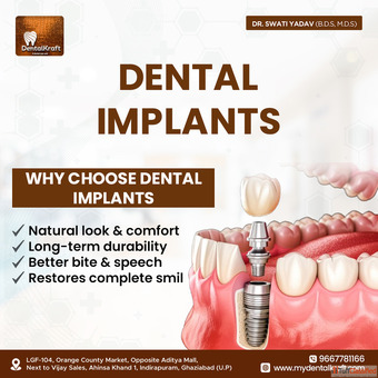 Dental Implant Doctor in Indirapuram for Safe Tooth Replacement