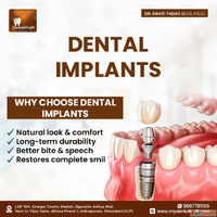 Dental Implant Doctor in Indirapuram for Safe Tooth Replacem...