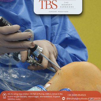 Dr. Krunal Soni - Advanced Total Knee Replacement in Ahmedabad