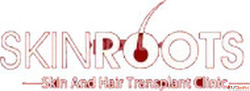 Hair Transplant Cost in Delhi