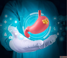 Best Stomach Cancer Surgeon in Ahmedabad - Dr. Nitin Singhal