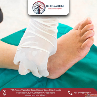 Safe Effective Gangrene Treatment in India by Dr.Krunal Gohil