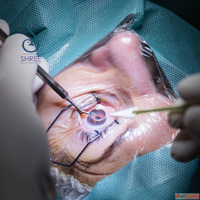 Cataract Surgery in Ahmedabad at Shree Eye and Dental Hospit...