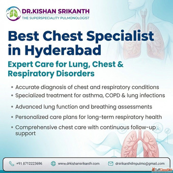 best chest specialist in hyderabad