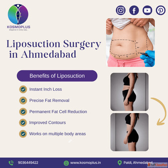 Best Liposuction Surgery in Ahmedabad at KosmoPlus