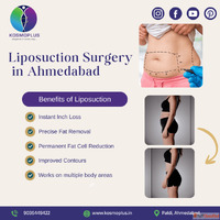 Best Liposuction Surgery in Ahmedabad at KosmoPlus