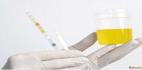 Book Urine Test Online from Max Lab