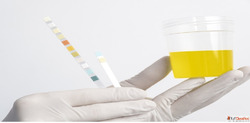 Book Urine Test Online from Max Lab