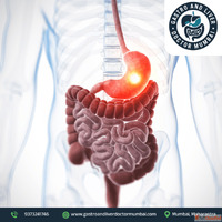 Get the best stomach cancer treatment in Mumbai - Dr. Shanka...