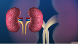 Is Kidney Failure Treatment Possible Through Homeopathy