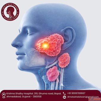 Expert Salivary Gland Cancer Treatment in Ahmedabad