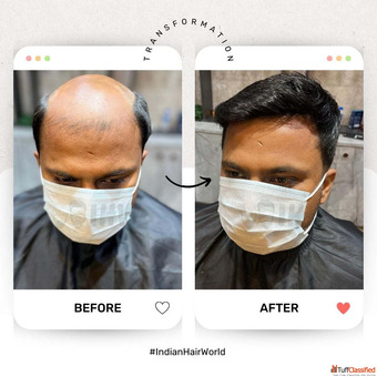 Hair Patch in Kolkata - Natural Look by Indian Hair World Salt Lake