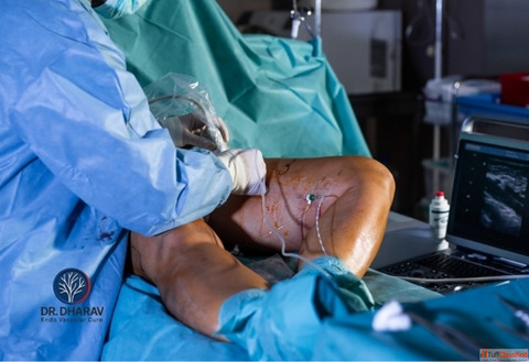 Expert Vascular Care by the Best Vascular Surgeon in India - Dr.Dharav Kheradia