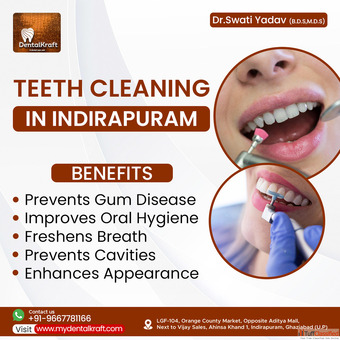 Teeth Cleaning in Indirapuram for healthy gums and teeth