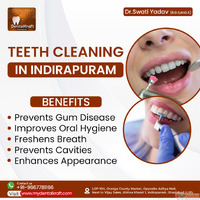 Teeth Cleaning in Indirapuram for healthy gums and teeth