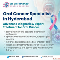 Oral Cancer Specialist in Hyderabad