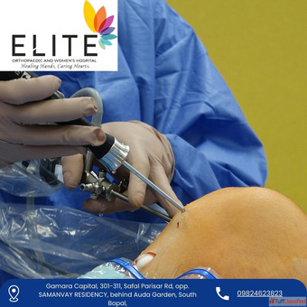 Best Knee Replacement Surgeon in Ahmedabad for Pain Relief - Elite Hospital