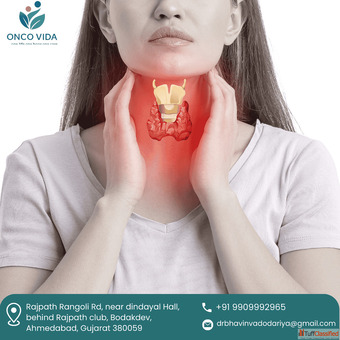 Advanced Thyroid Cancer Surgeon in hmedabad Dr. Bhavin Vadodariya