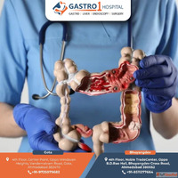 Advanced Colon Cancer Treatment in Ahmedabad - Gastro1 Hospi...