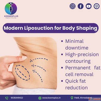 Best Liposuction Surgery in Ahmedabad for Body Contouring by KosmoPlus