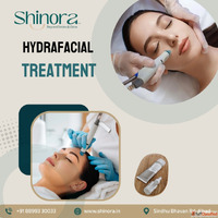 Shinora Clinic - Advanced HydraFacial Treatment in Ahmedabad...