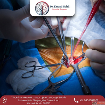 Dr.Krunal Gohil - Best Vascular Surgeon in India for Advanced Vascular Treatments