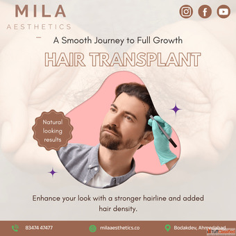 Best Hair Transplant in Ahmedabad - Mila Aesthetics