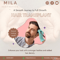 Best Hair Transplant in Ahmedabad - Mila Aesthetics