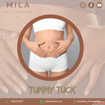 Best Tummy Tuck Surgery in Ahmedabad at Mila Aesthetics