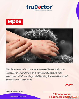 Best Hospital Marketing Company in Varanasi - Trudoctor