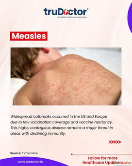 Best Hospital Marketing Company in Varanasi - Trudoctor