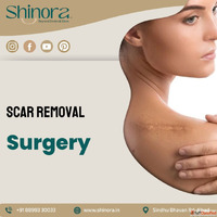 Shinora Clinic - Best Scar Removal Surgery in Ahmedabad for ...