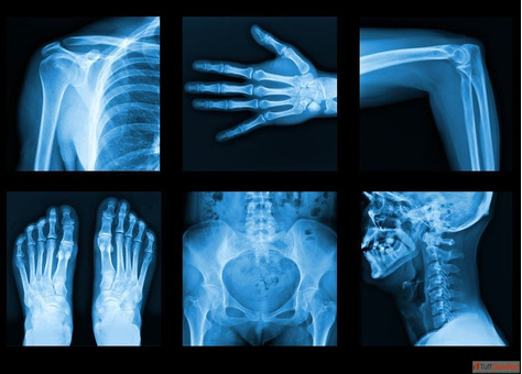 Advanced X-Ray OPG Services in South Delhi - SVMC