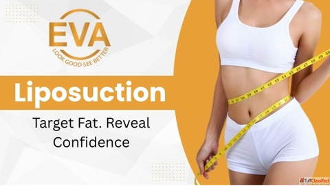 Beyond the Scalpel Exploring Non-Surgical Liposuction Options in Delhi