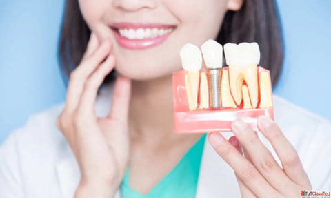 Dental Implant Surgery Treatment in Gangapur Road Nashik