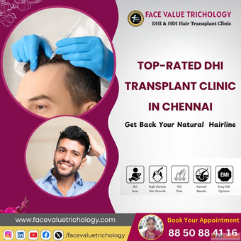 The Best Hair Transplant Suregeon Clinic in Chennai