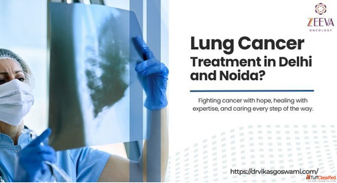How Is Radiation Therapy Used for Lung Cancer treatment in Delhi and Noida