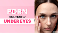 PDRN Under Eye Treatment - Dermapuritys