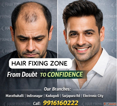 Hair loss doesn't define you confidence does.