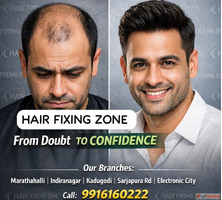Hair loss doesn't define you confidence does.